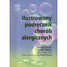 ILUSTROWANY PODRĘCZNIK CHORÓB ALERGICZNYCH