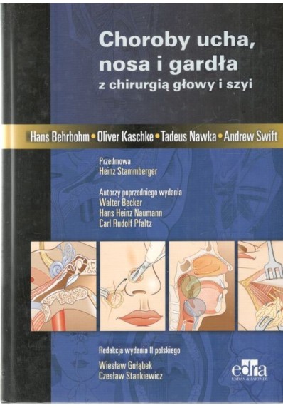 CHOROBY UCHA, NOSA I GARDŁA Z CHIRURGIĄ GŁOWY I SZYI